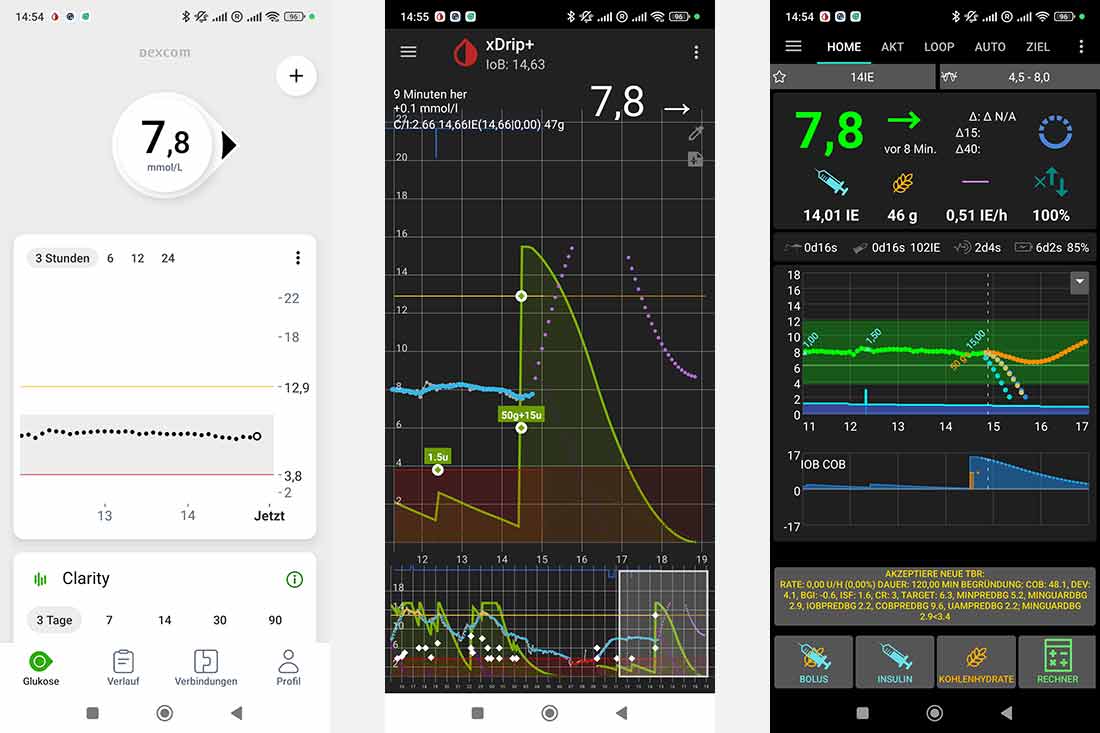 Dexcom G7 // xDrip+ // AAPS